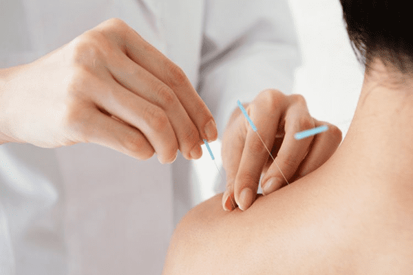 Điều trị phồng lồi đĩa đệm bằng Đông Y phù hợp với nhiều đối tượng