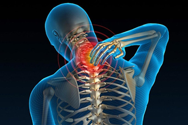 Vôi hóa đốt sống cổ gây ra nhiều biến chứng nguy hiểm