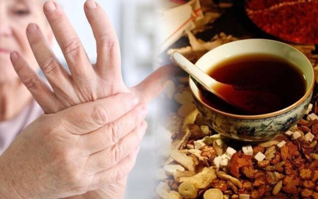 Chữa viêm đa khớp dạng thấp Thái Bình: Giải pháp an toàn, hiệu quả từ Đông y